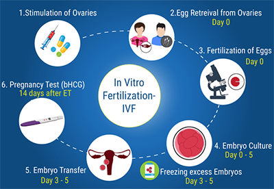 ivf-process