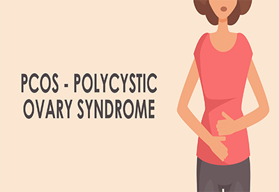 PCOS1