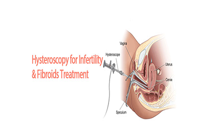 hysteroscopy-1