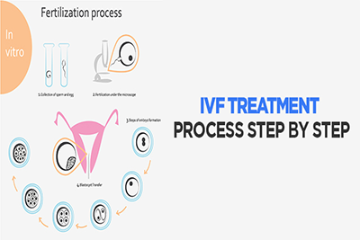 ivf procedure