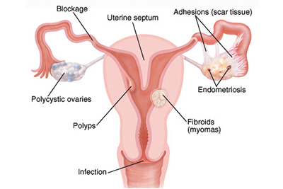 fallopian tube