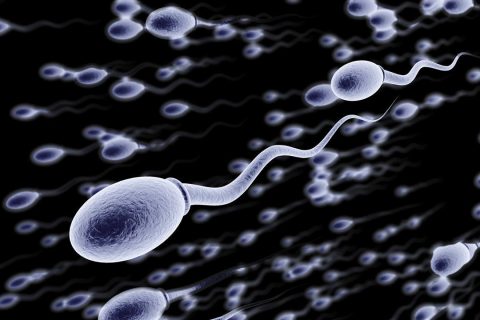 sperm sorting