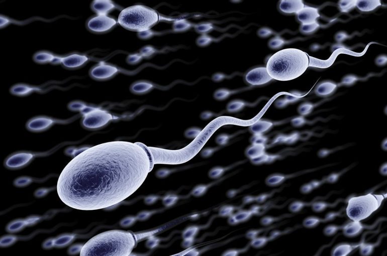 sperm sorting