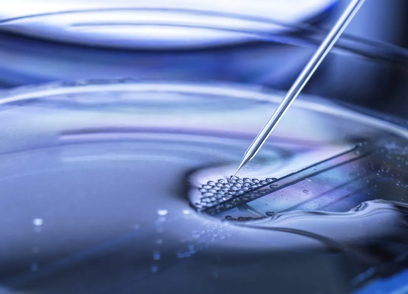 Ivf Treatment - Nordica Fertility Centre - Top IVF Facility in Nigeria - Best IVF in Lagos, Asaba, Abuja