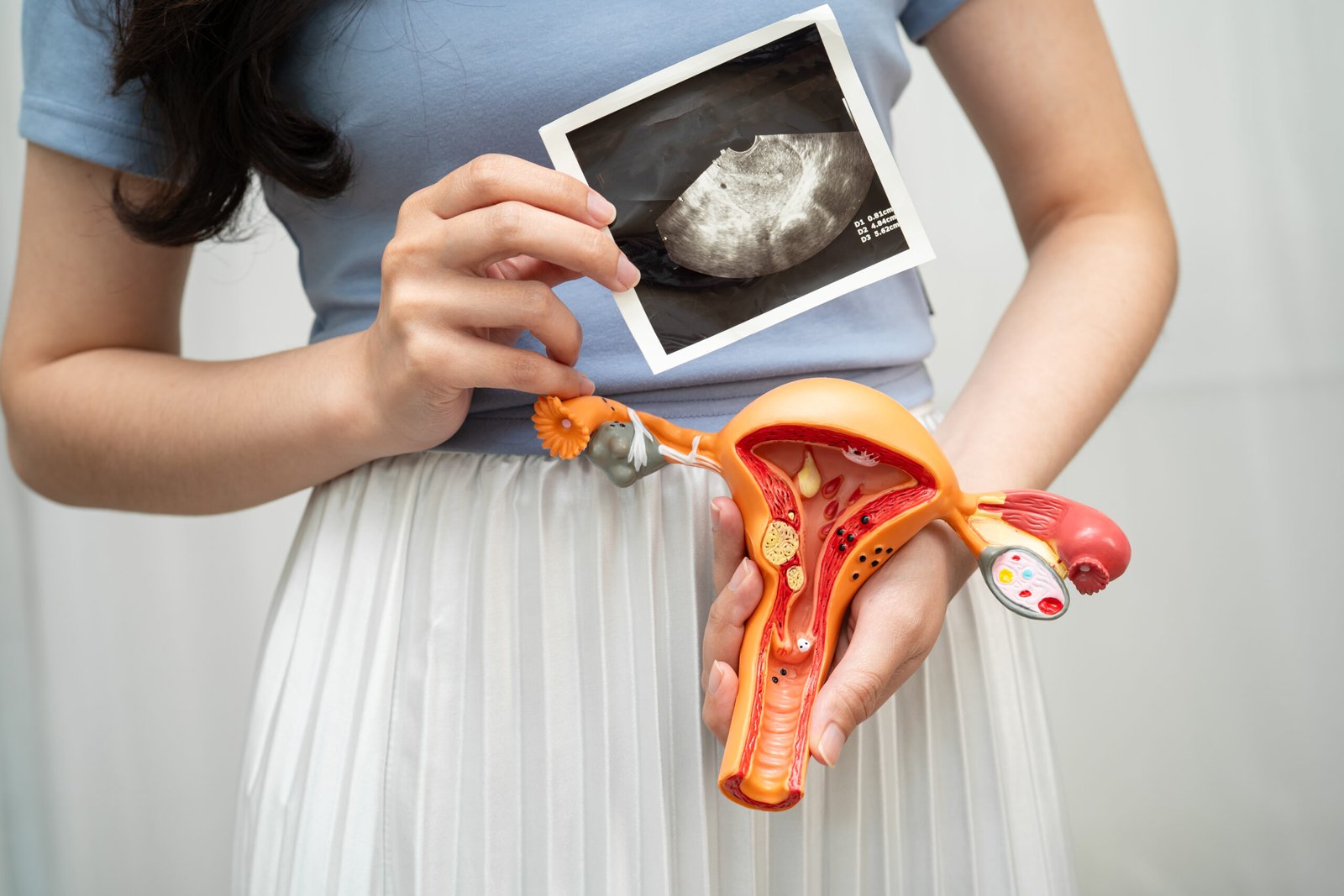 woman holding ultrasound and reproductive system m 2026 09 25 00 22 32 utc scaled - Nordica Fertility Centre - Top IVF Facility in Nigeria - Best IVF in Lagos, Asaba, Abuja